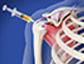 Regenerative Medicine
                      